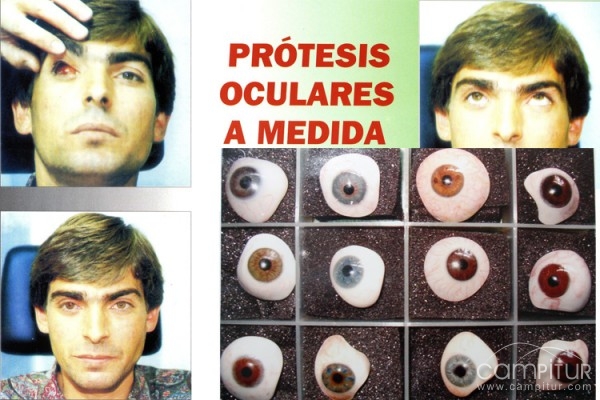 G.Canónico Ópticos